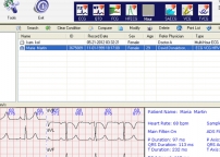 Holter Analysis Software